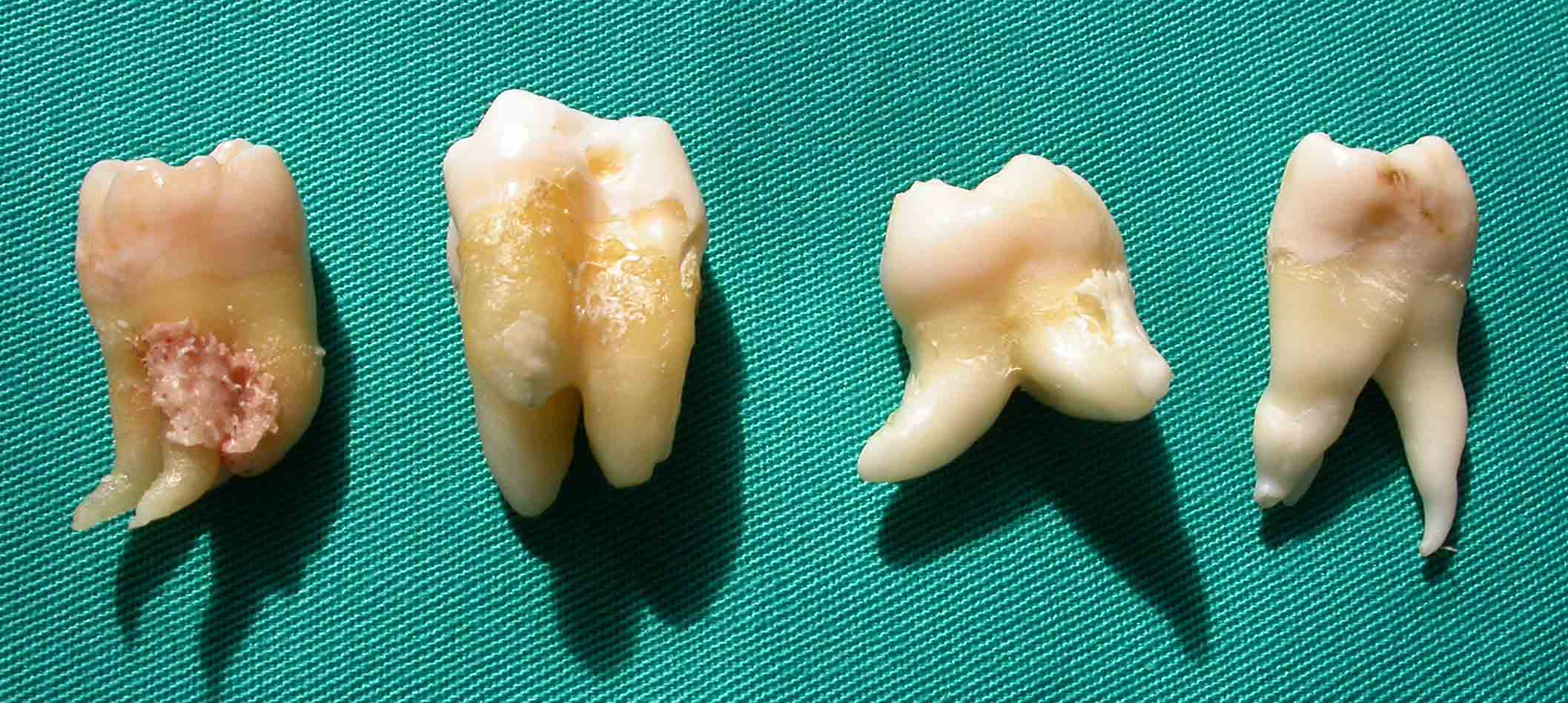 Zahnformen